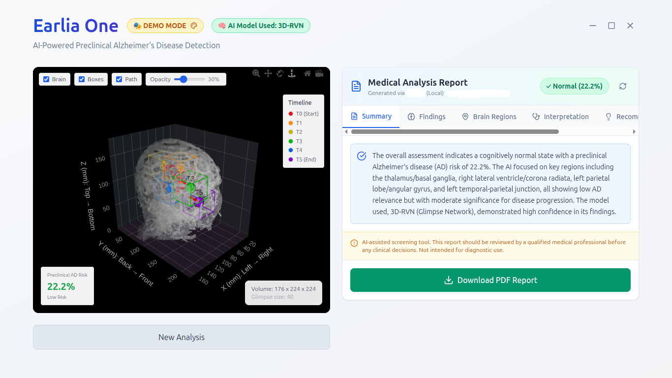 Earlia One desktop application showing a 3D brain MRI with a spatial attention overlay